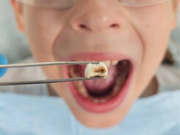 Best Emergency Dentist for Special Needs Patients in Decherd, TN